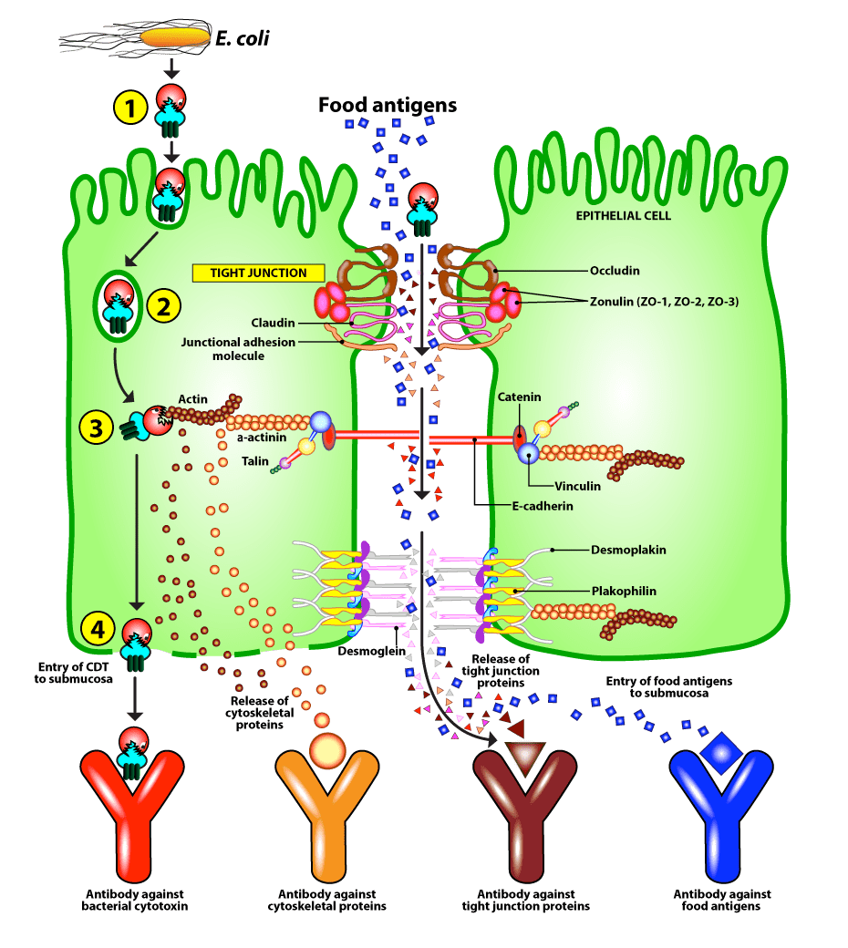 Cyrex Array 22 - Irritable Bowel/SIBO Screen
