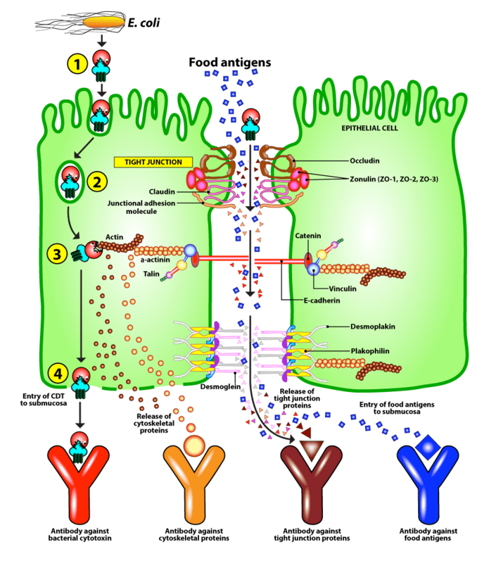 Cyrex Array 22 - Irritable Bowel/SIBO Screen