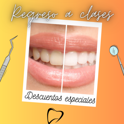 Blanqueamiento Dental