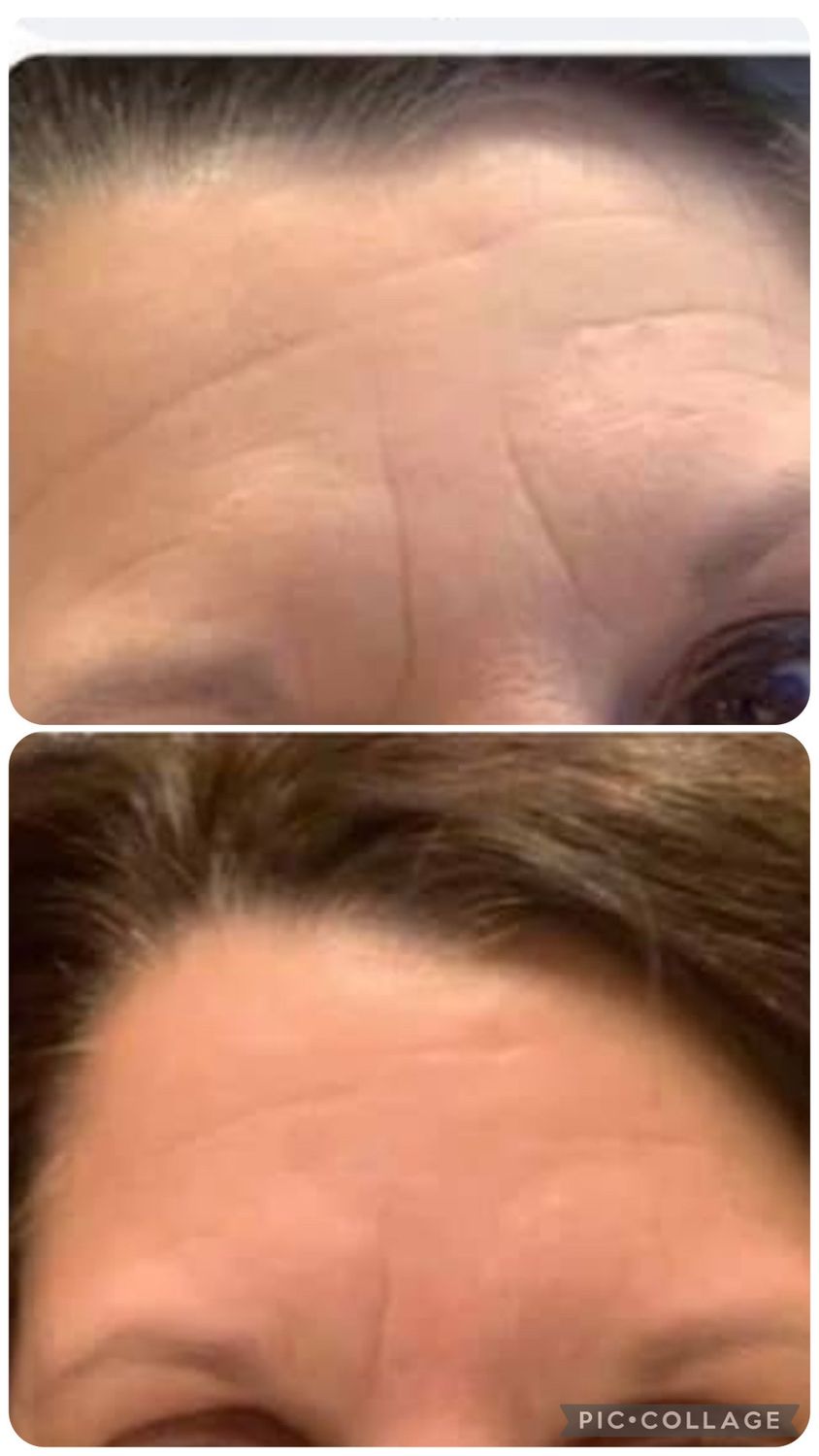 Peptide Line Corrector