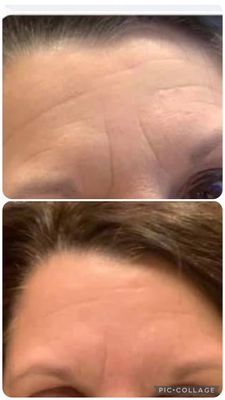 Peptide Line Corrector