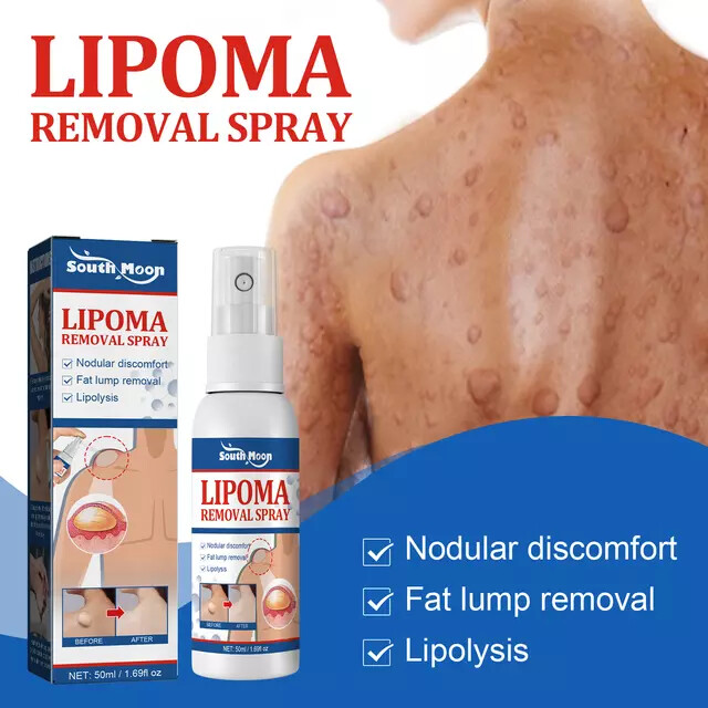 Lipoma Removal Cream Relief Pain Treat Skin Swelling Lipolysis Cellulite Fat Lump Nodule Removal Ointment Anti-tumor Plaster