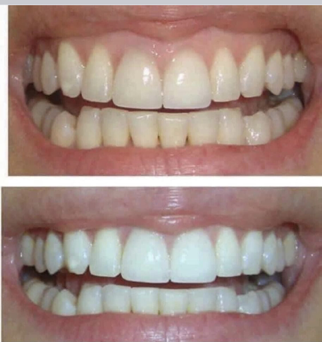 AP-Whitening Fluoride Toothpaste