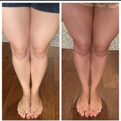 InstaGlo Sunless Tanner