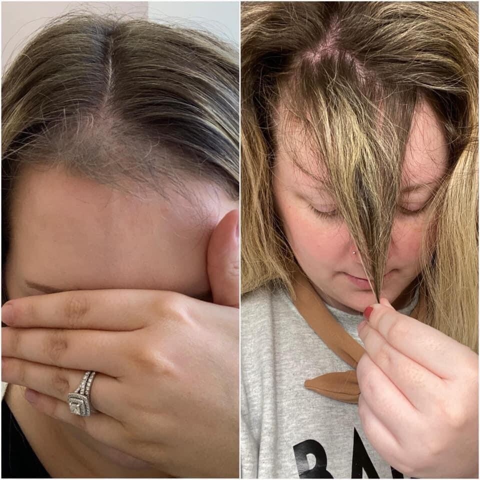 Scalp And Hair System