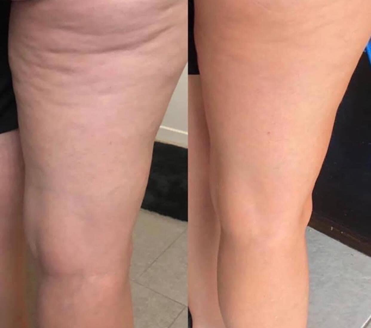 Firming/Cellulite Cream