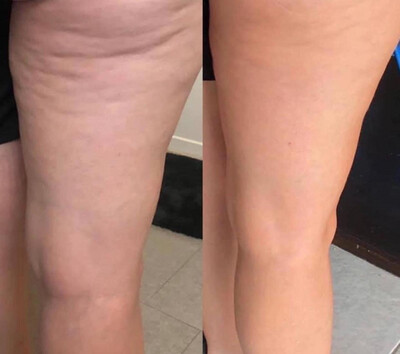 Firming/Cellulite Cream
