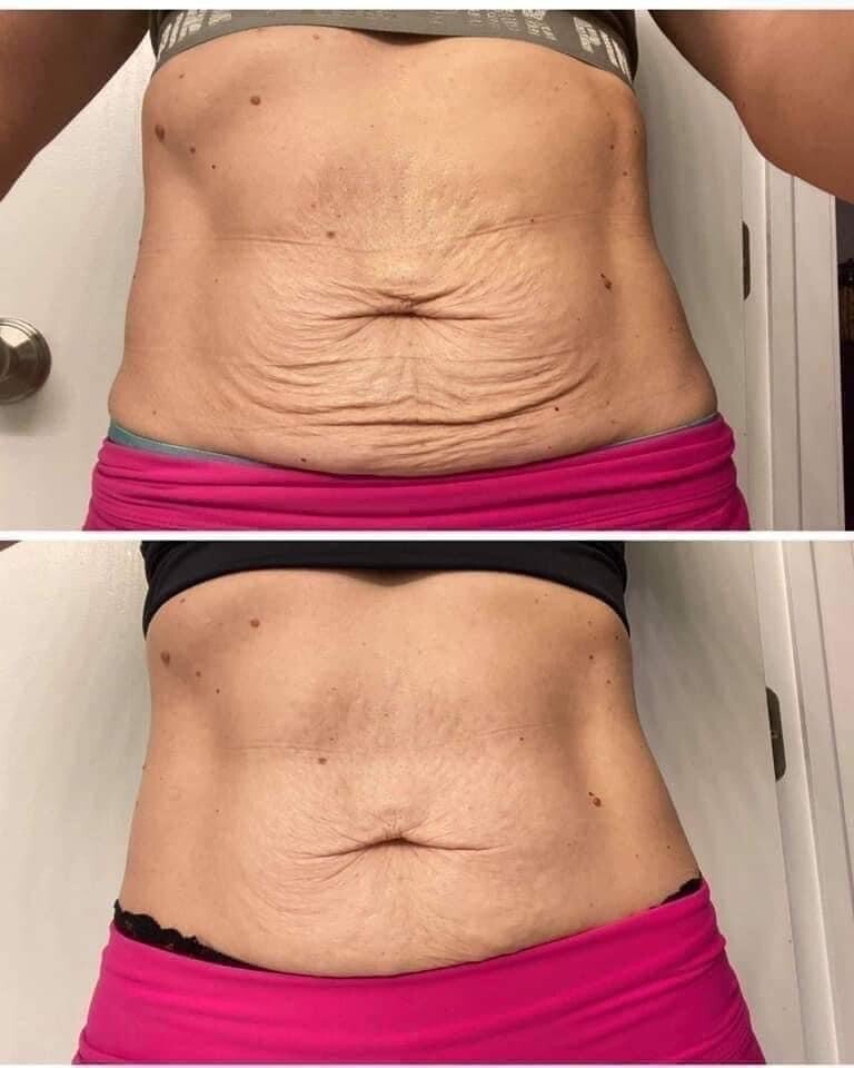 Firming/Cellulite Cream