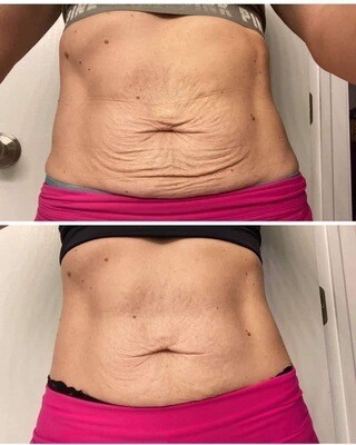 Firming/Cellulite Cream