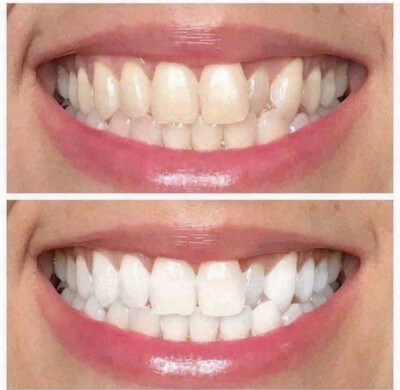 Family four Pack Whitening Toothpaste