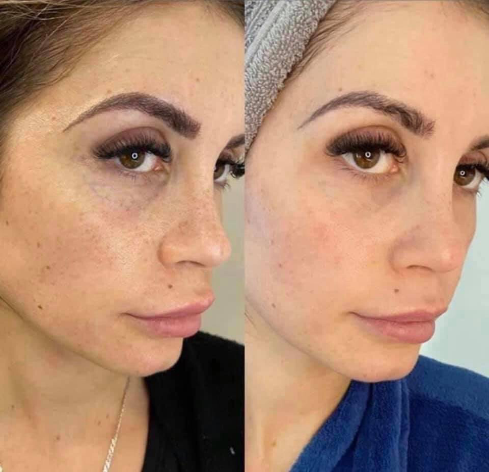 Vitamin C Face Wash