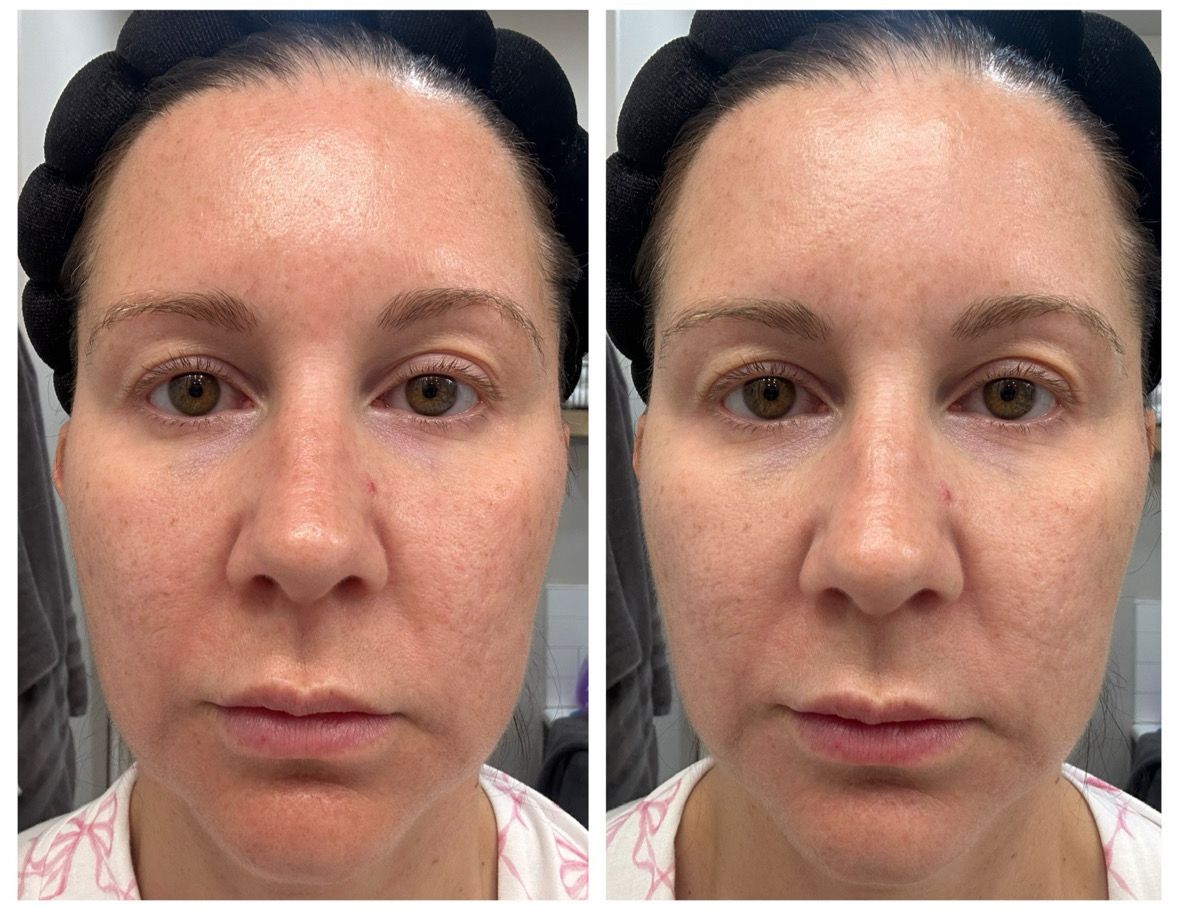 Epoch Cica Balm