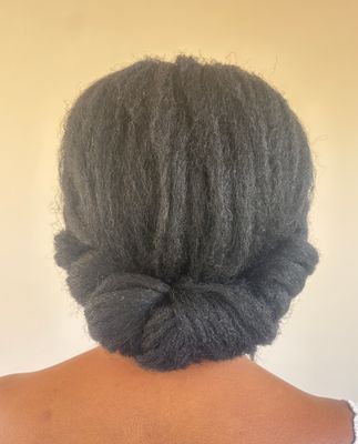 Alopecia &amp; Hair Loss Restoration With BongiFabuHair