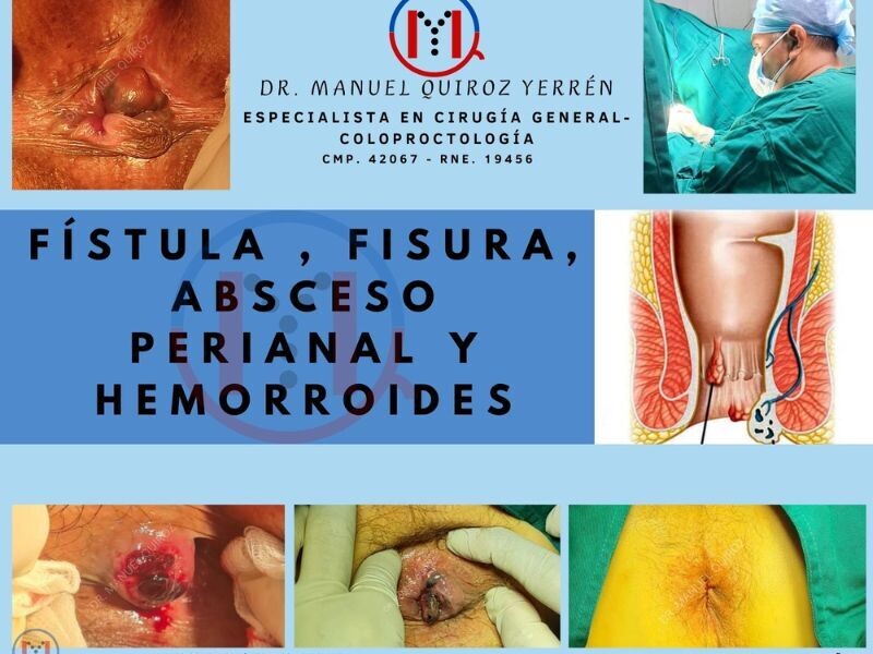 Coloproctología