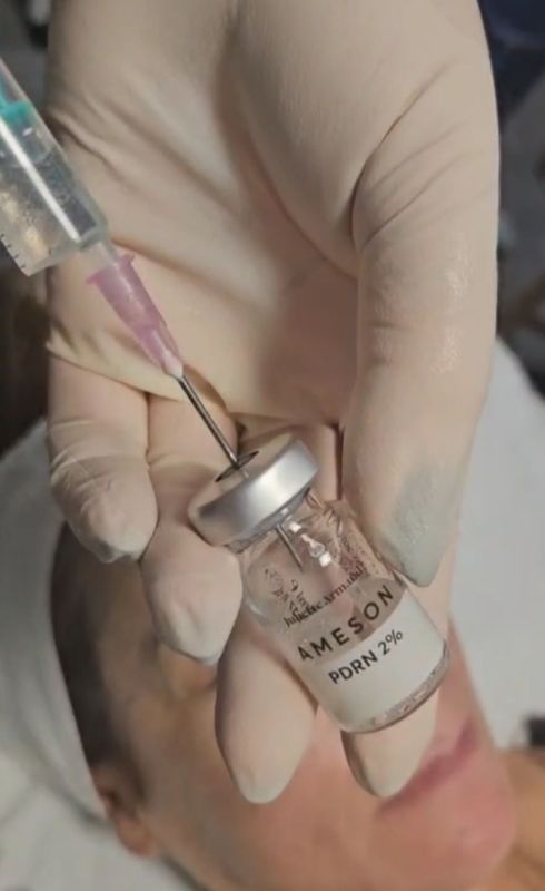 PDRN (Polynucleotide) Microneedling Treatment by Ameson Juliette Armand