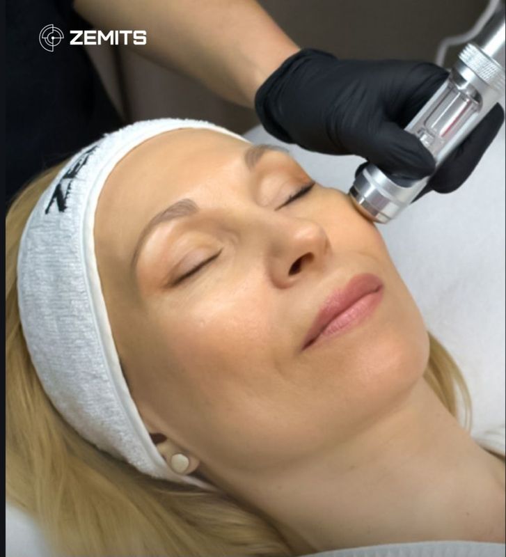 Mesotherapy Electroporation (Needle-Free)