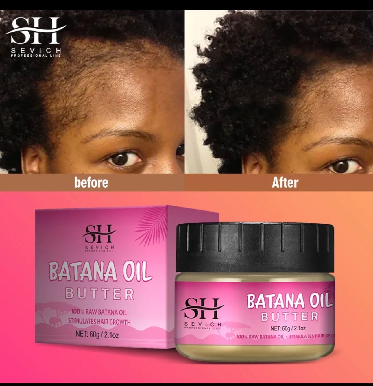 Batana Oil ( Timo Dadashada, Agoolka,qaleelka Timaha)