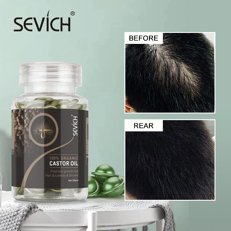 Sevich