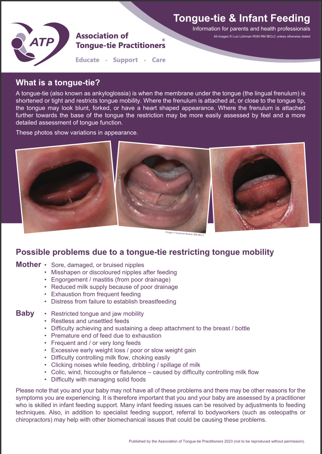 Tongue Tie & Infant Feeding A5 Leaflet