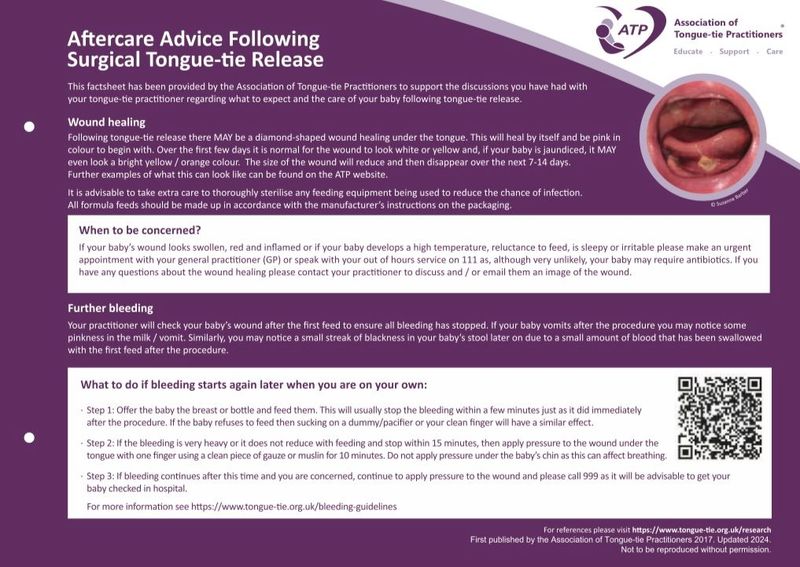 Care After Tongue-tie Release Factsheet (2024)