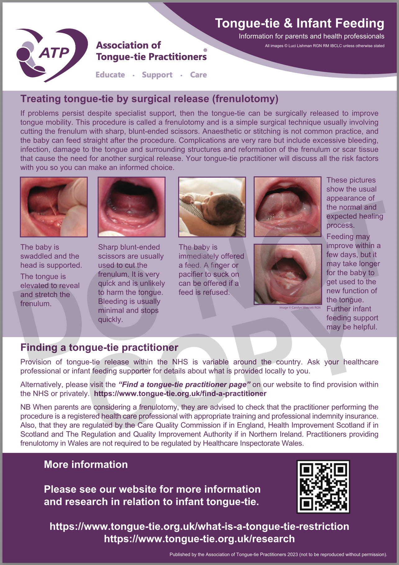 Tongue-tie & Infant Feeding (2023) *FREE DOWNLOAD*