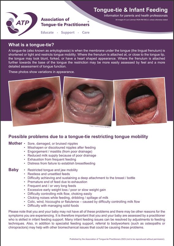 Tongue-tie & Infant Feeding  A5 Leaflet (2023)