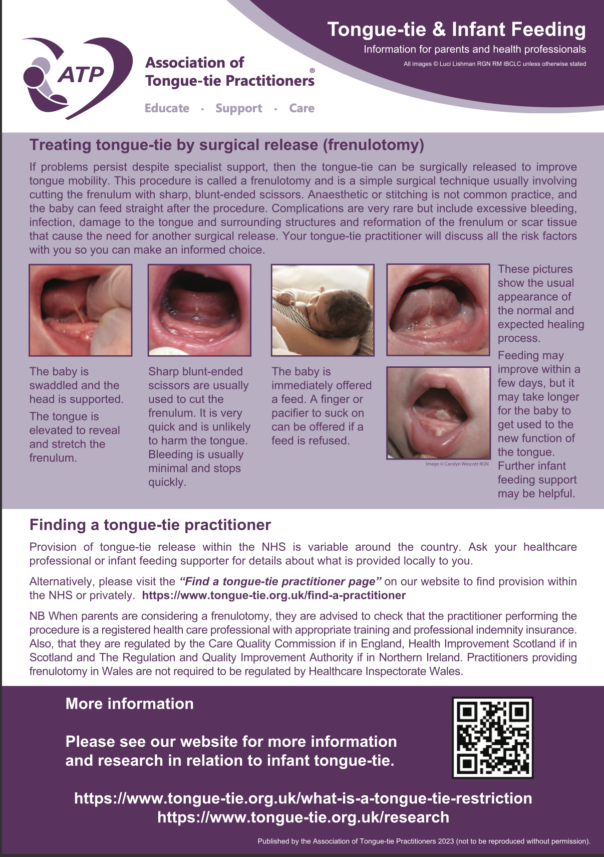 Tongue-tie & Infant Feeding A5 Leaflet (2023)