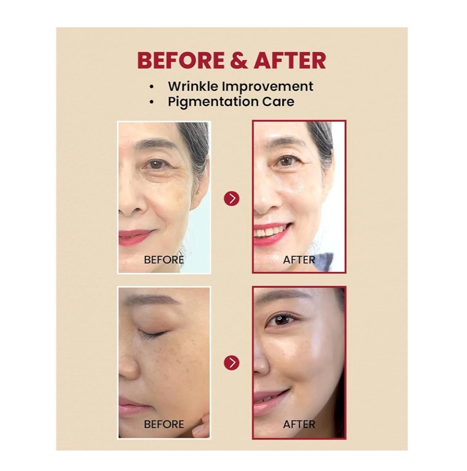 Serum Retinal 2% con Ginseng negro- Seoul 1988 - Ksecret - Top