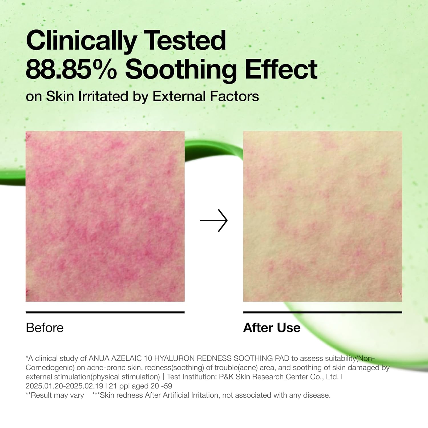 Anua | Pads Calmantes | Acido Azelaico 10% y Acido Hialuronico | 90 Pads - top