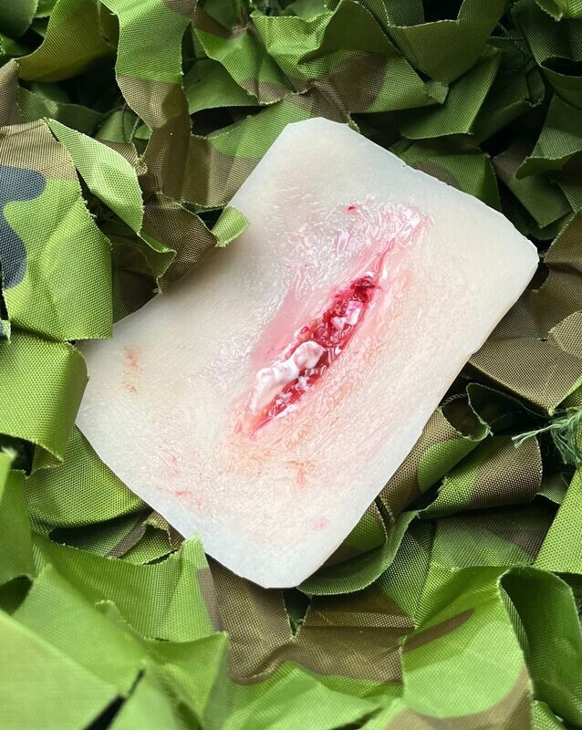 Kleine Splitterverletzung