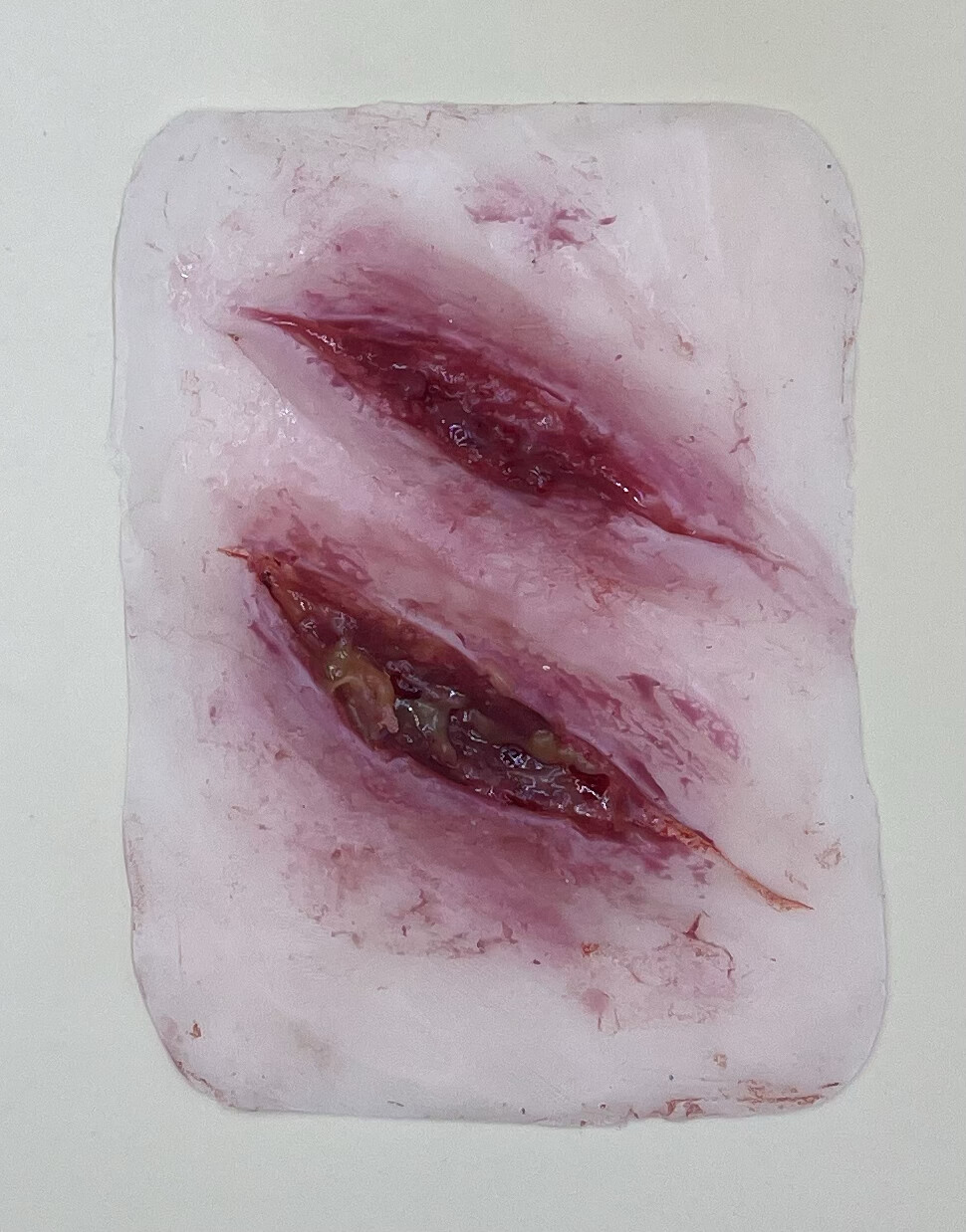 Doppelte Schnittwunde Klein