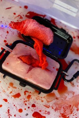 Woundpacking