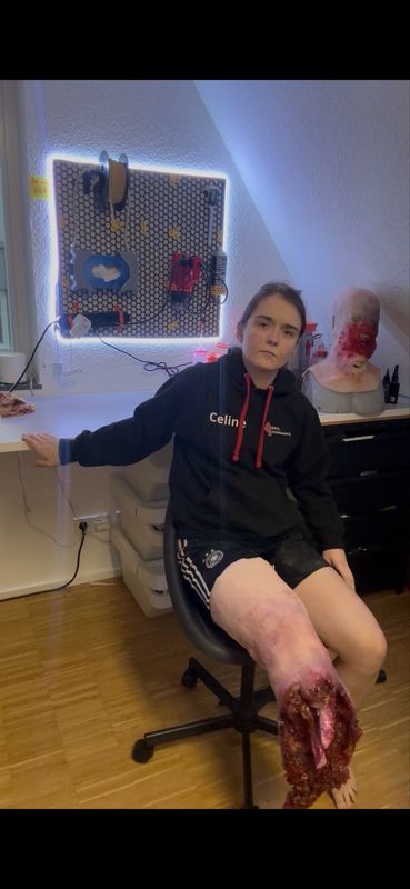 Unterschenkel Amputation Überzieher mit Blutung