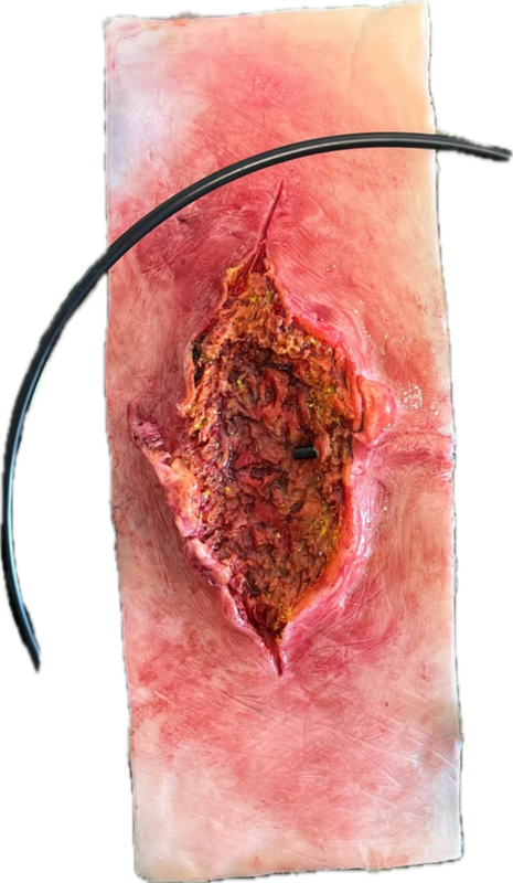 Tiefe Risswunde mit Blutungsfunktion