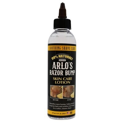 Arlo's Razor Bump Skin Care Lotion 6 oz.