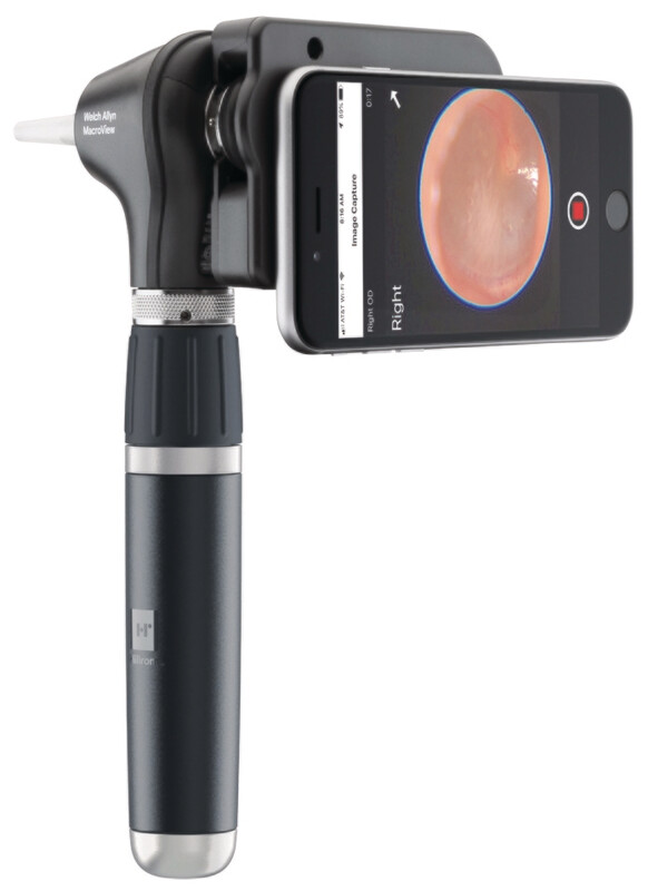 OTOSCOPE WELCH ALLYN MACROVIEW™ 2 PLUS IXAMINER