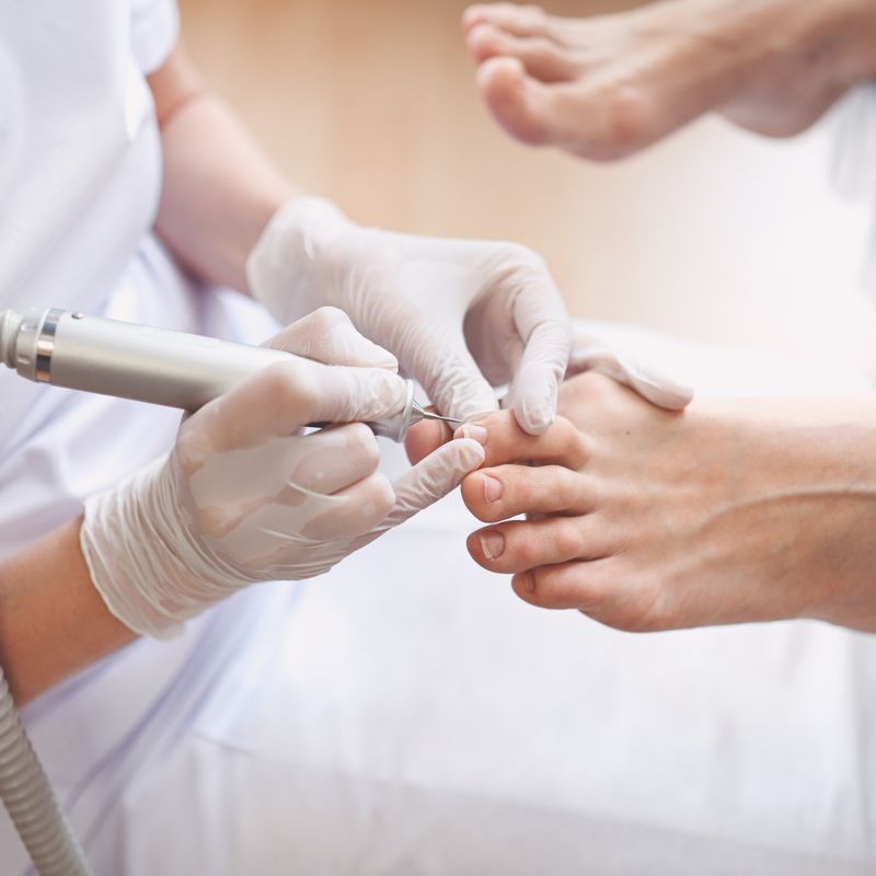 Medische pedicure