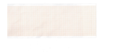 ECG thermic papier voor ECG toestel 1200G - doos van 5 stuks