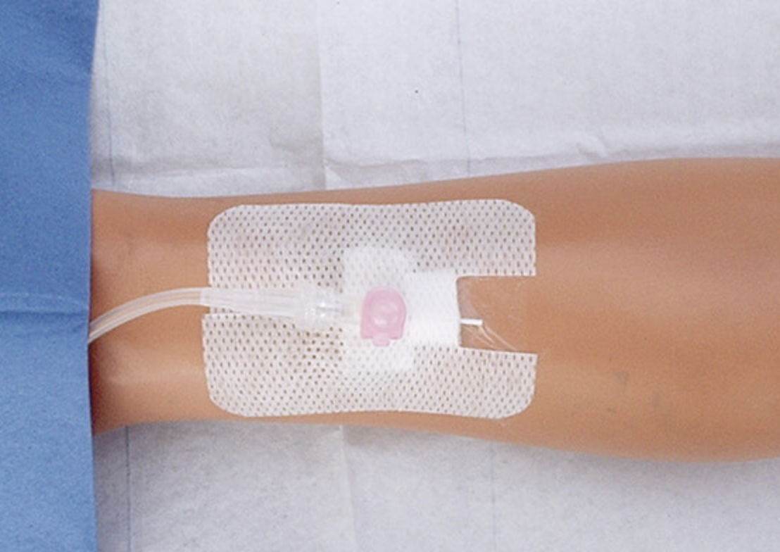Infuuspleister per stuk