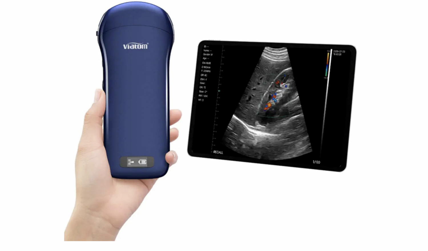 Viatom 3 in 1 draadloze ultrasound scanner