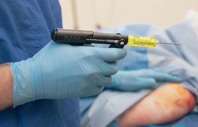 SAM IO Driver - Intraosseous Access System