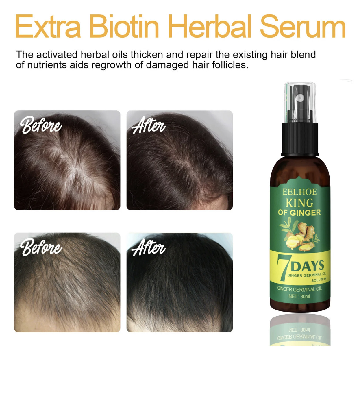 Eelhoe Serum Pousse Cuire cheveux