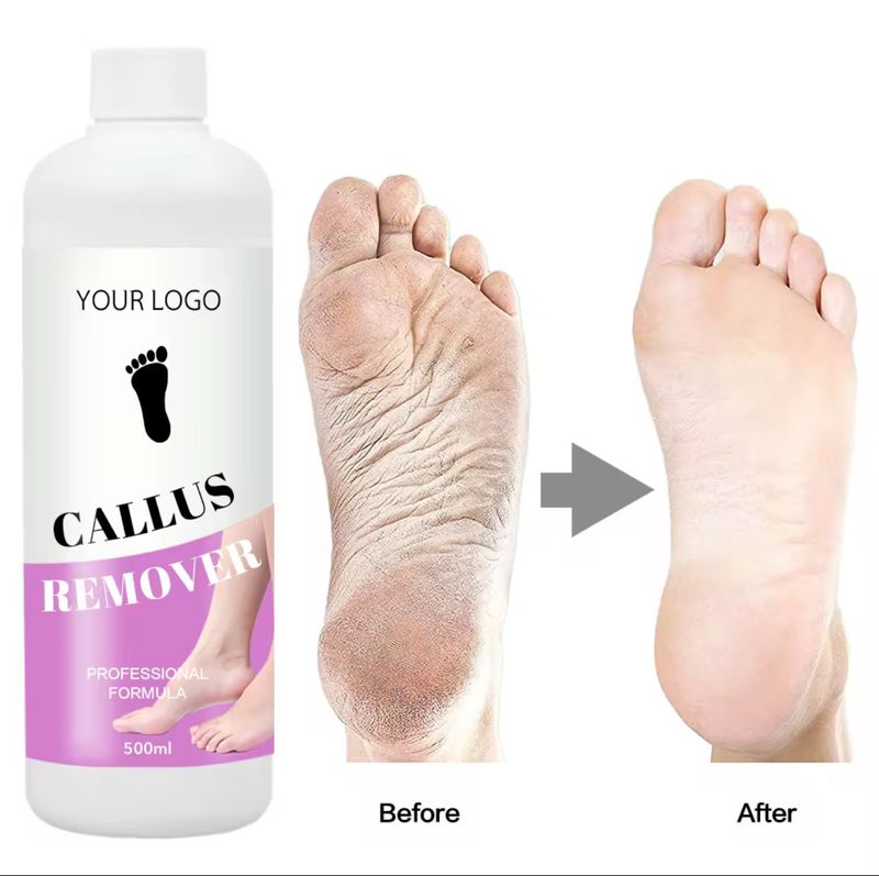 Cal Nettoyant Pied 250ml Cal Nettoyant Pied 250ml