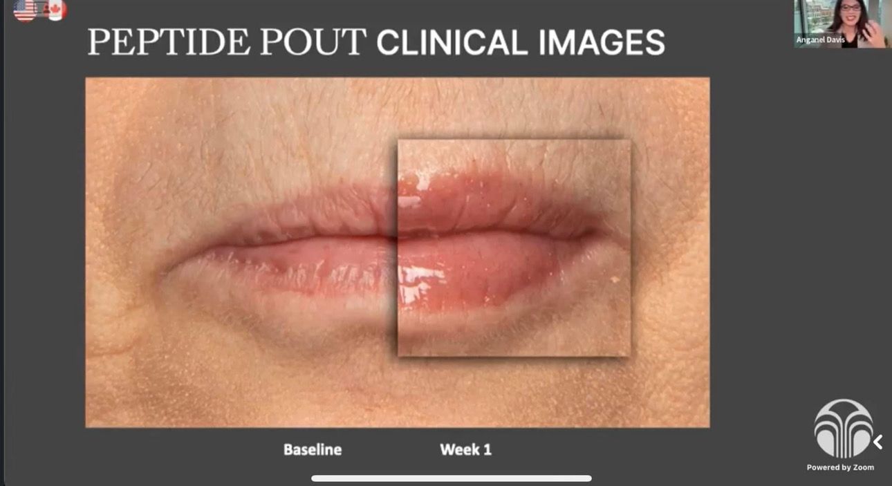 Peptide Pout