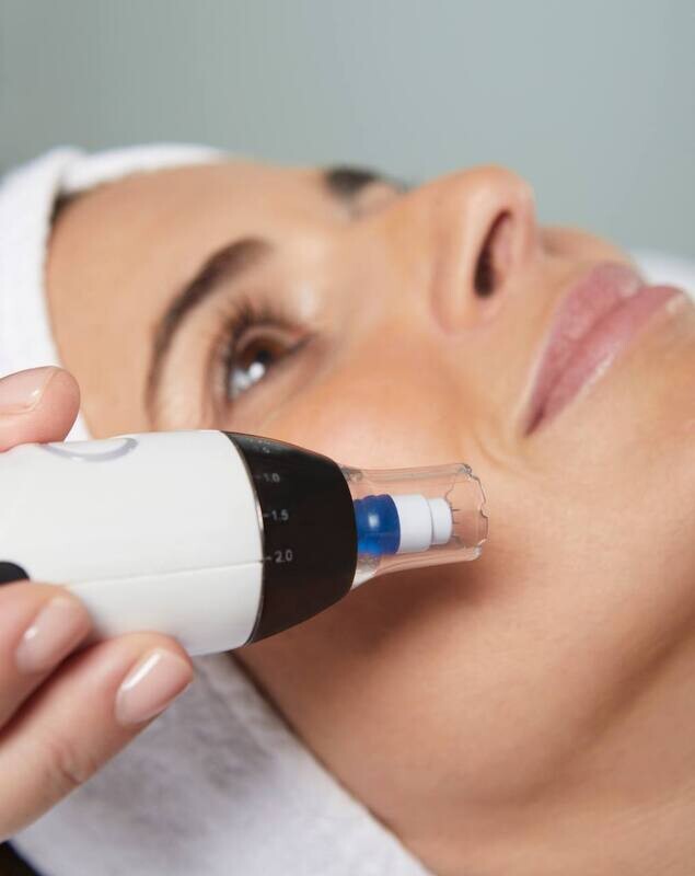 VEGA FACIAL. MICROPUNCIÓN
