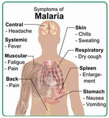 Major symptoms of Malaria