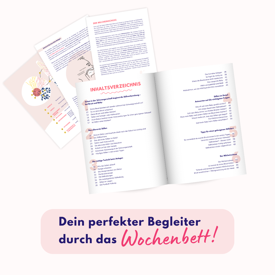 Stillstart (für Fachpersonal)