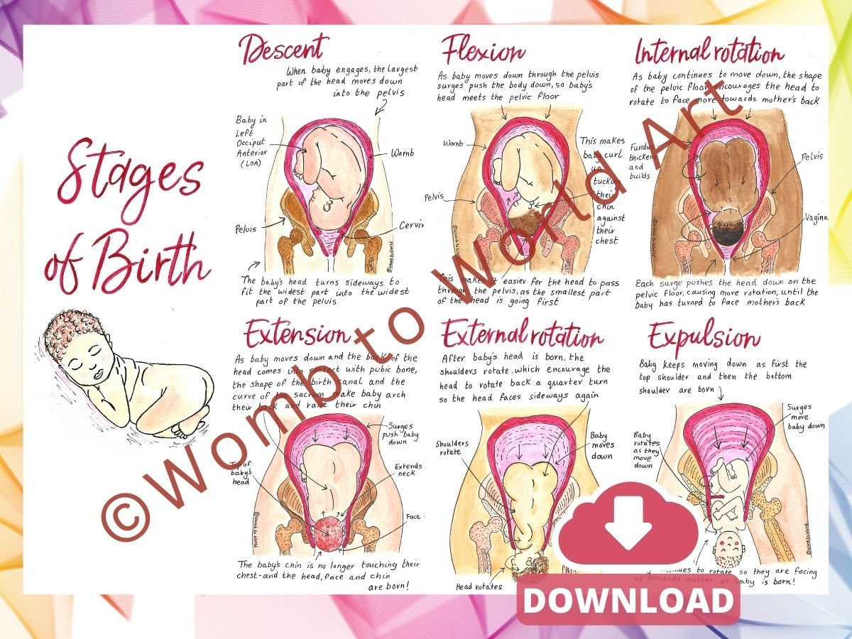 Cardinal Movements of Birth A2 Poster Teaching Tool