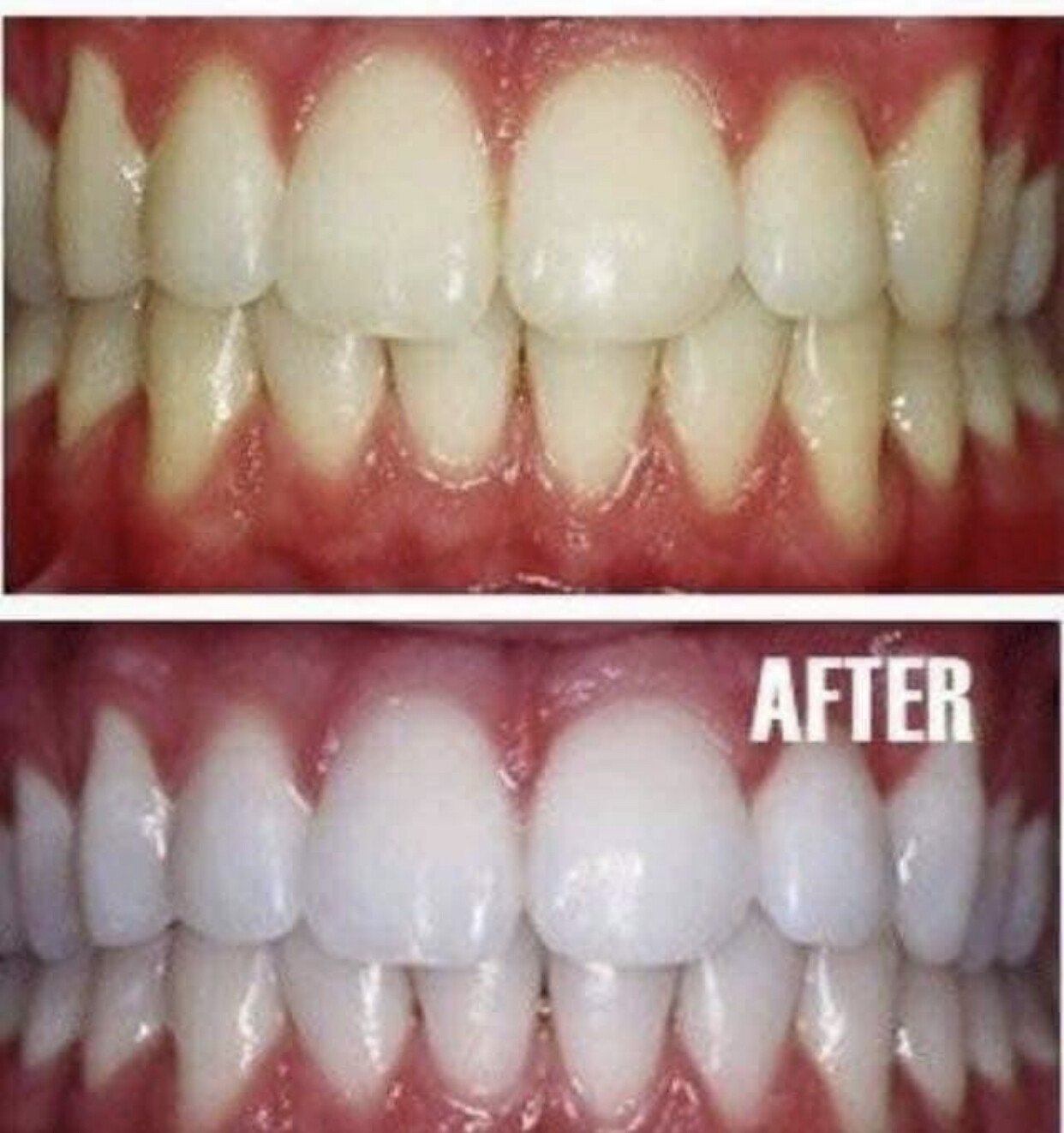 AP 24 Whitening Toothpaste