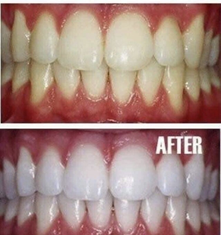 AP 24 Whitening Toothpaste